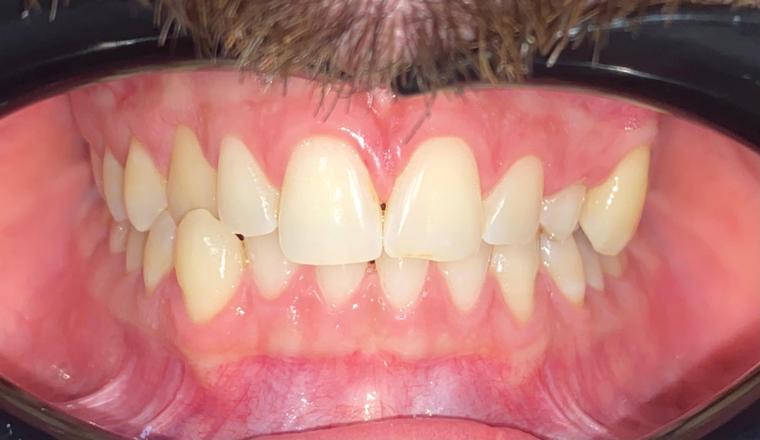 WhatsApp Image 2025-10-08 at 11.03.16 WhatsApp Image 2025-10-08 at 11.03.16